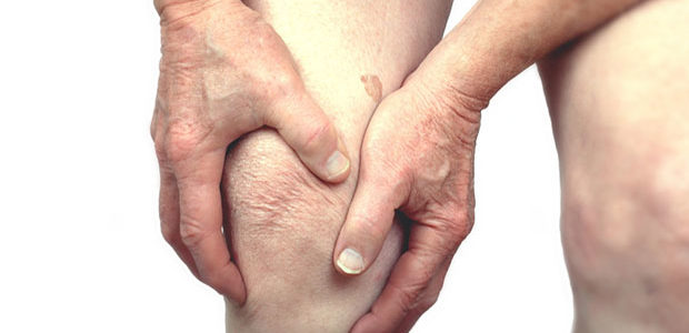 Artritis Reumatoide