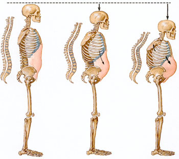 osteoporosis-huesos-columna