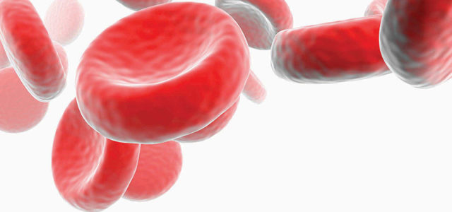 Anemia