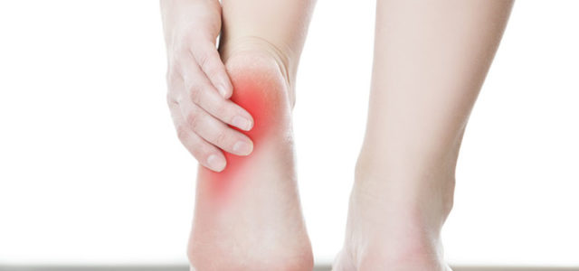 Fascitis Plantar