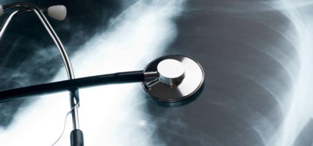 Sarcoidosis