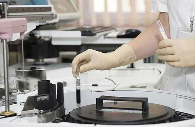 Biosensor que puede preveer tumores