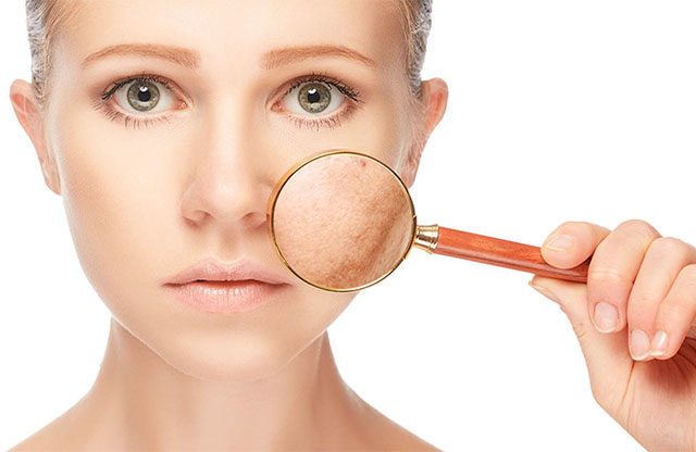 La calefacción puede ser perjudicial para la piel