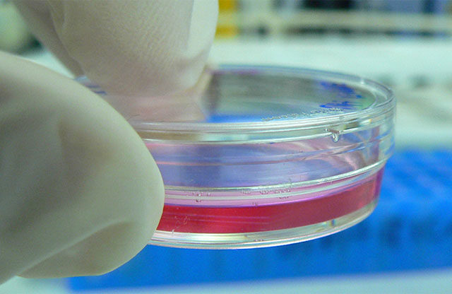 Cultivar órganos para transplantes