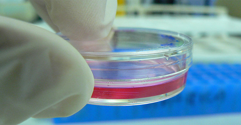 Cultivar órganos para transplantes