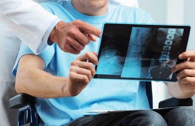 Esclerosis Múltiple