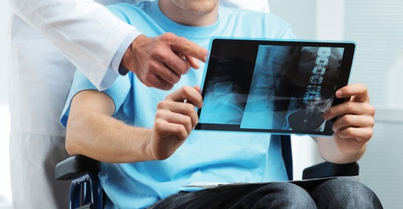 Esclerosis Múltiple