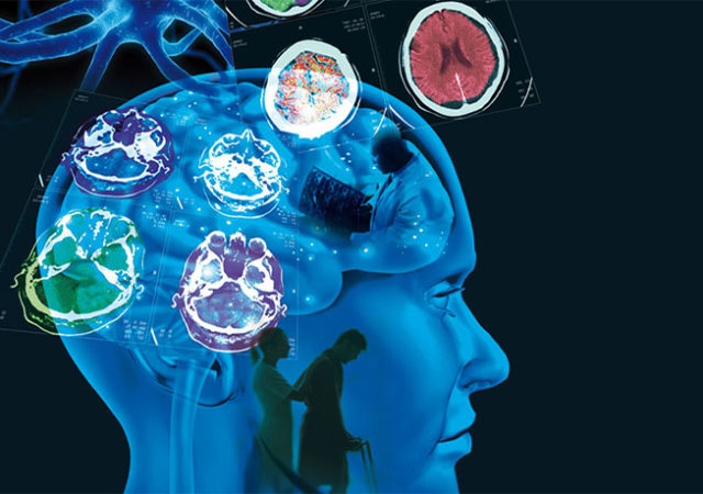 Esclerosis Múltiple