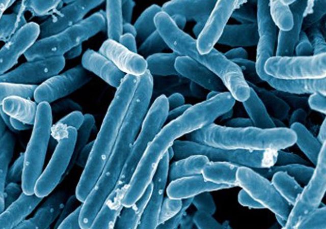 Tuberculosis