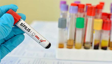 Diagnóstico Sífilis