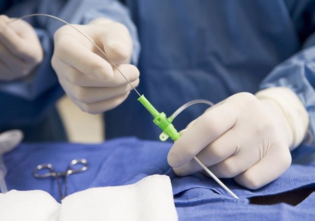 Cateterismo cardíaco