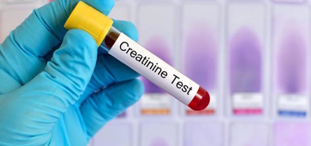 Creatinina