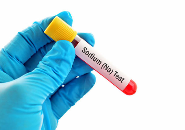 Niveles de Sodio en sangre